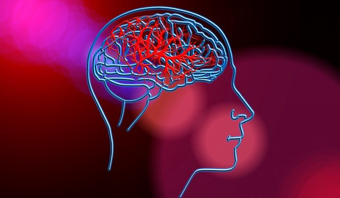ictus cerebrale