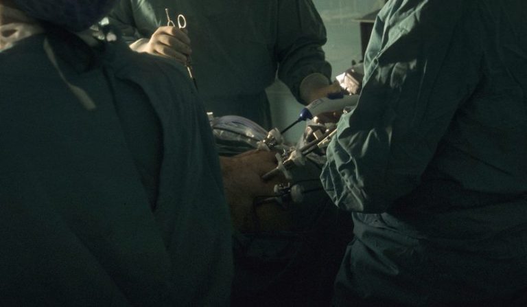 operato al polmone sbagliato