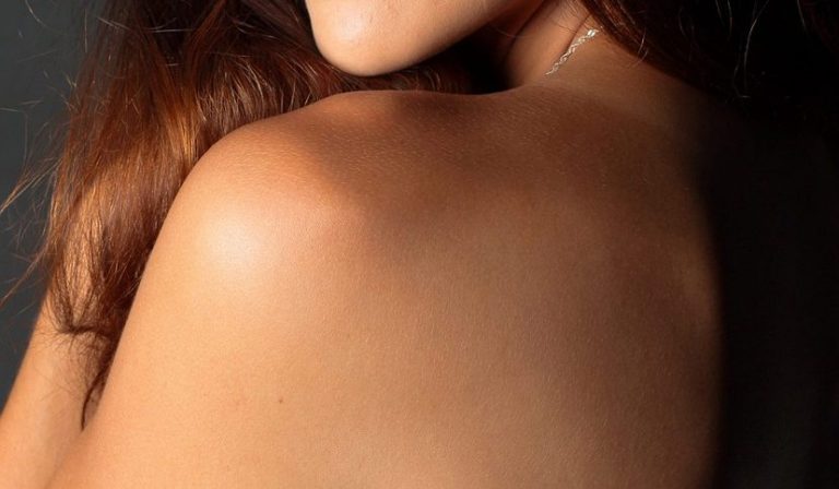 sindrome da conflitto della spalla