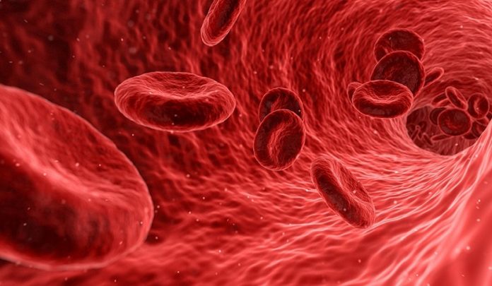 trasfusione con sangue infetto