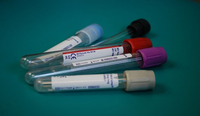 epatite cronica da hcv