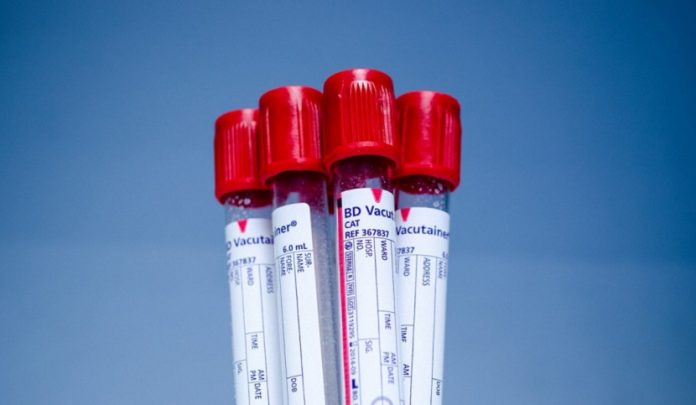 scontagio da emotrasfusione infetta