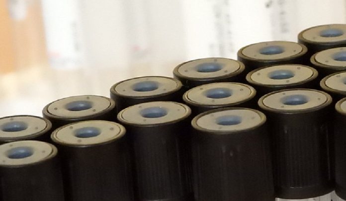 epatite cronica