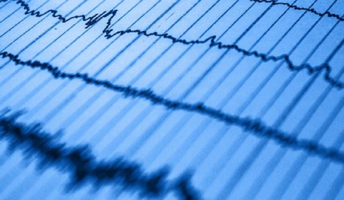 arresto cardiocircolatorio