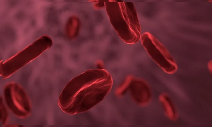 emotrasfusioni infette