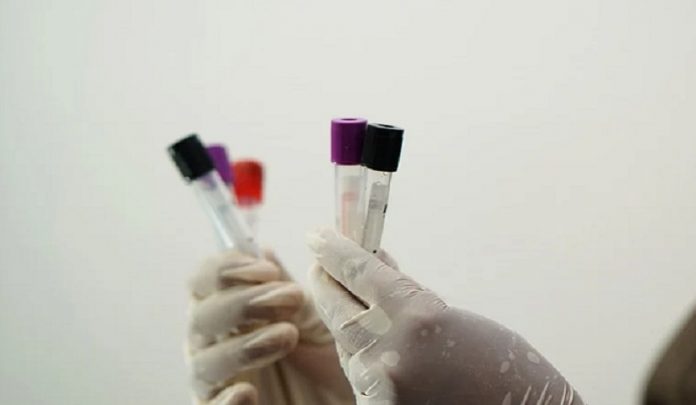 trasfusioni
