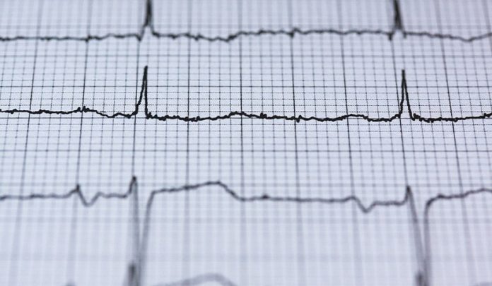 tre arresti cardiaci
