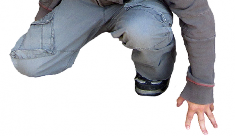 meniscopatia degenerativa