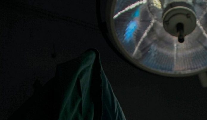sostituzione della valvola aortica