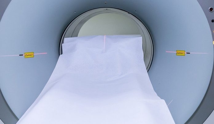 morto per una trombosi