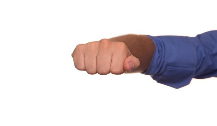 SOGLIA-INDENNIZZABILITA-RESPONSABILE-CIVILE sogli di indennizzabilità