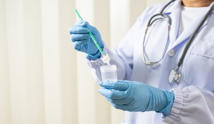Doctor,Hand,Holding,Liquid,Base,Cytology,Set,On,Blue,Background.gynecologist Errata diagnosi nella refertazione dell'esame Pap Test