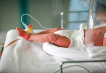 Lesioni agli arti inferiori e superiori del neonato al momento del parto