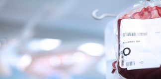 Epatite C post-trasfusionale e il danno differenziale