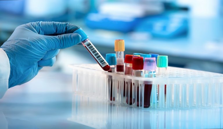 Contagio da emotrasfusione: risarcimento e indennizzo