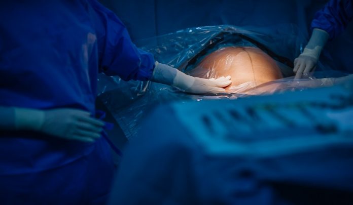 Perdita del figlio durante il parto cesareo d'urgenza