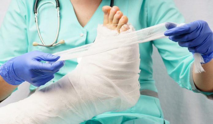 Frattura metatarso piede sinistro per insidia stradale