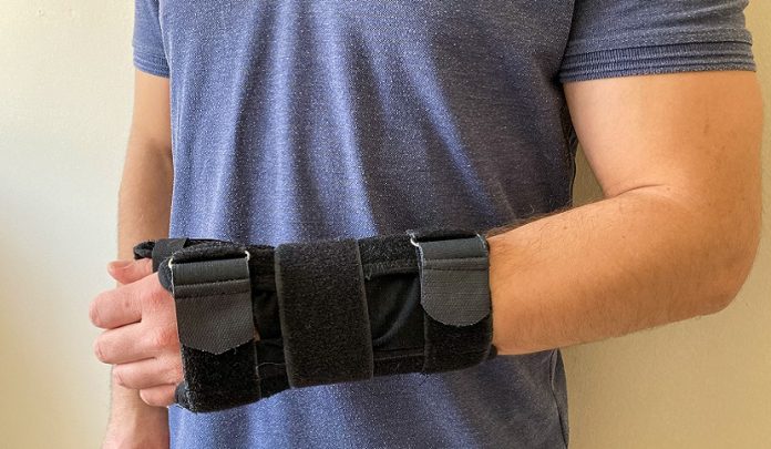 Frattura pluriframmentaria mano sinistra per caduta