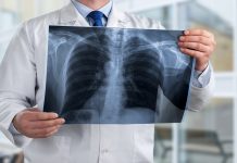 Ritardo diagnostico e responsabilità del Medico Radiologo