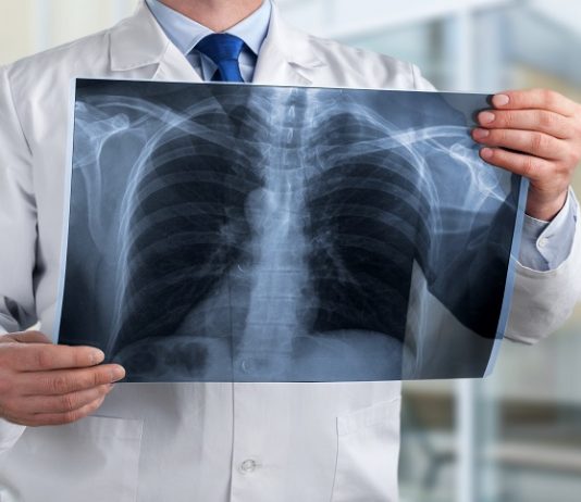 Ritardo diagnostico e responsabilità del Medico Radiologo
