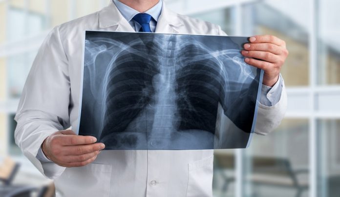 Ritardo diagnostico e responsabilità del Medico Radiologo