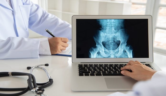 Paraplegia del paziente conseguente a catetere epidurale