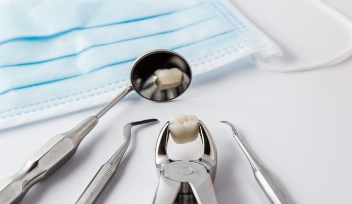 Estrazione dente del giudizio inferiore e lesione del nervo linguale
