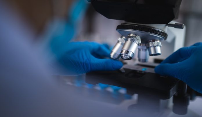 Melanoma maligno tardivamente diagnosticato per omesso istologico