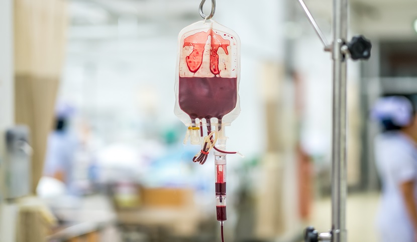 HCV da emotrasfusione di sangue infetto e danni risarcibili