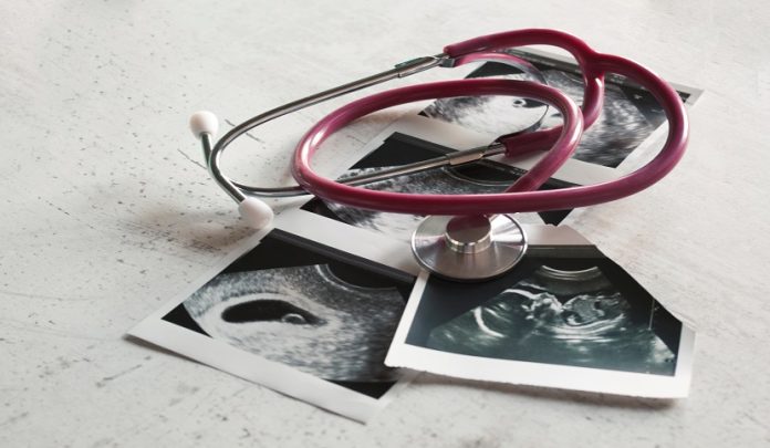 In,The,Pictures,Of,The,Ultrasound,4,Weeks,Of,Pregnancy Aborto per errato trattamento sanitario e ammissibilità dell'ATP