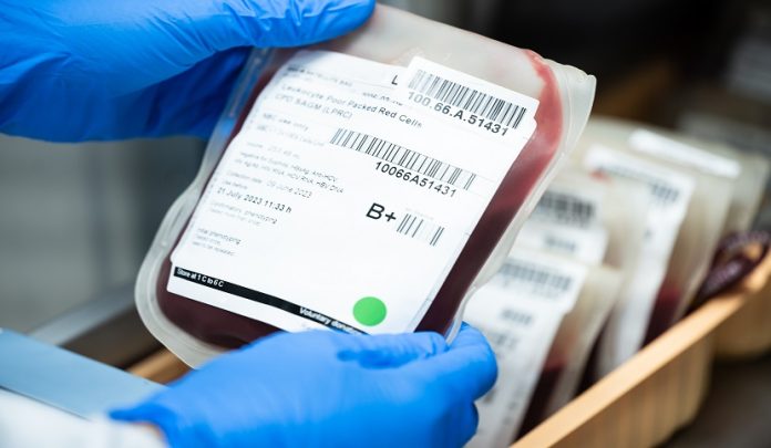 Close,Up,Scientist,Hand,Holding,Red,Blood,Bag,In,Storage Danno lungolatente e dies a quo per il diritto al risarcimento