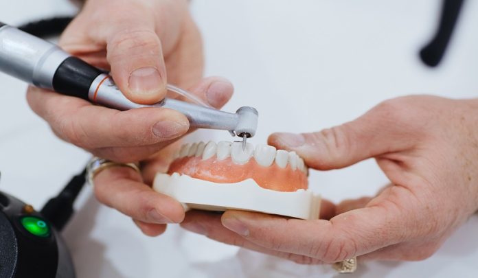 Realizzazione implanto protesica causa problemi di masticazione