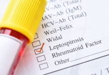 diagnosi-tardiva-leptospirosi-nesso-causale