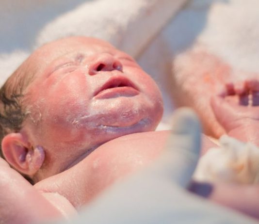neonato-parto-paralisi-al-braccio
