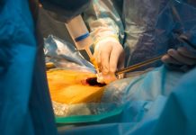 intervento-laparoscopia-linee-guida
