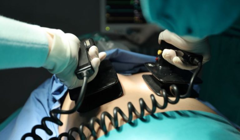 ritardo-nelle-cure-rianimatorie