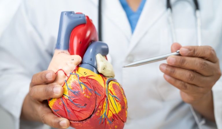 Rivascolarizzazione-miocardica