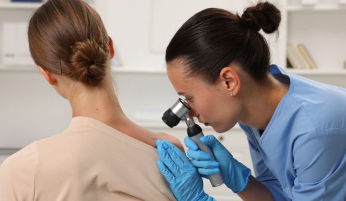 cure-alternative-melanoma