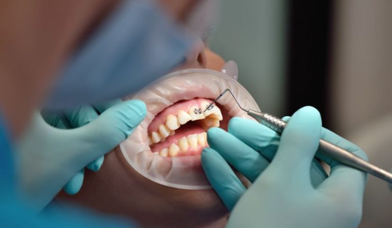 Responsabilità-odontoiatrica